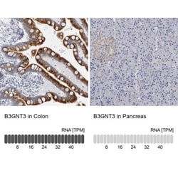 B3GNT3 Antibody, Novus Biologicals:Antibodies:Primary Antibodies